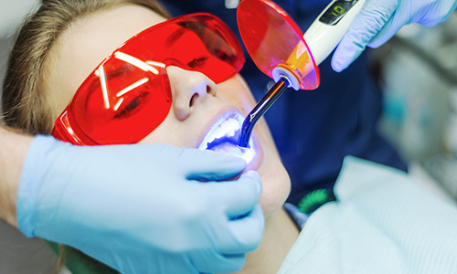 Laser Dentistry